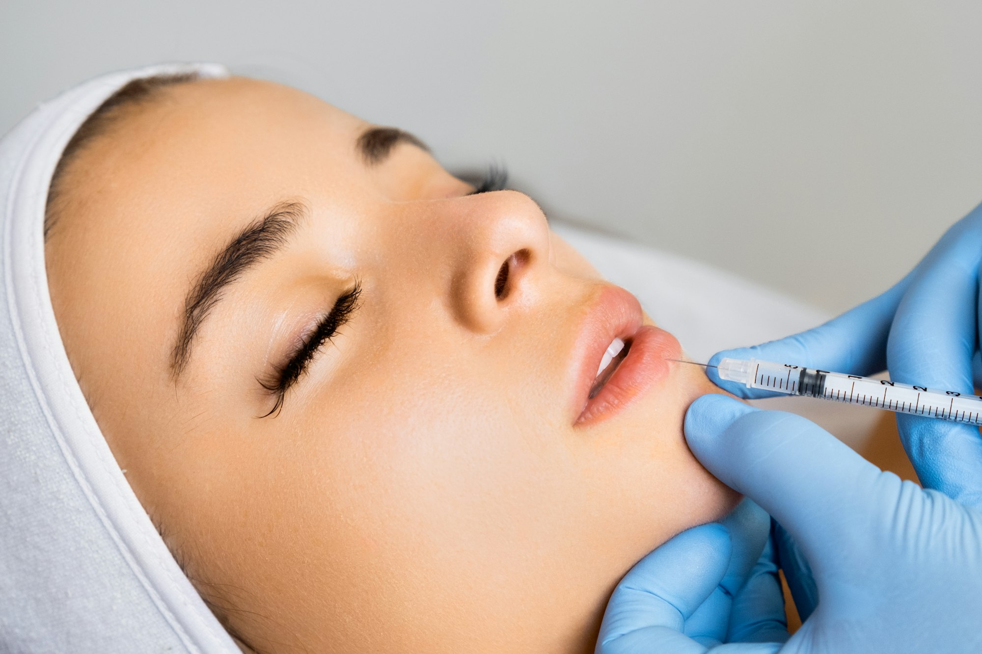 Beauty injection for lip augmentation in a beauty salon